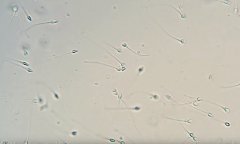 1200倍的显微镜能看到精子吗
