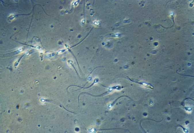 精子在高倍显微镜下的样子