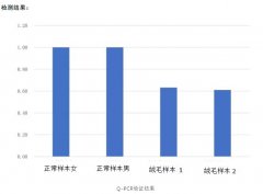 染色体Xp22.33微缺失的流产案例