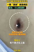 踏青归来患怪病？警惕恙虫病的威胁